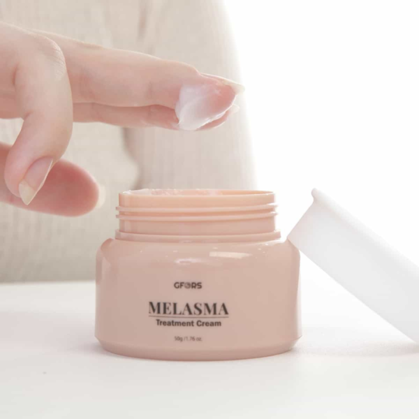 GFORS Melasma Treatment Cream Lavish life