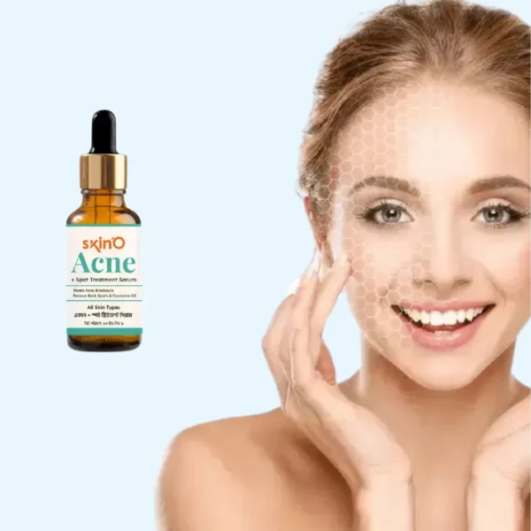 skin'O Acne + Spot Treatment Serum Lavish Life