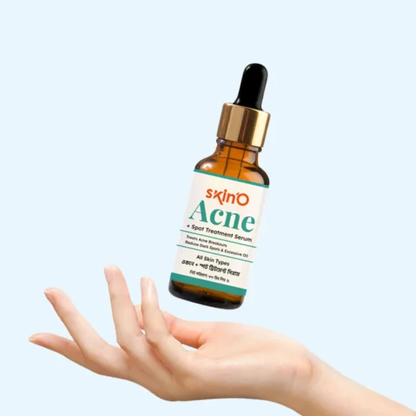 skin'O Acne + Spot Treatment Serum Lavish Life
